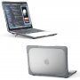 Удароустойчив капак с накланящи се крачета за MacBook Pro 13" (A2251 / A2289 / A2338) - сив